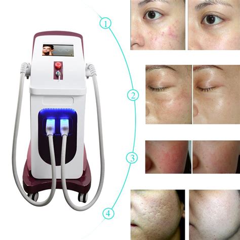 New Arrival Elight Shr System Multifunction Ipl Rf Skin Care Hair