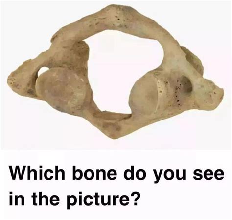 Identify The Bone Medizzy