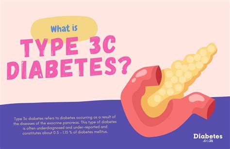 What is Type 3c Diabetes?