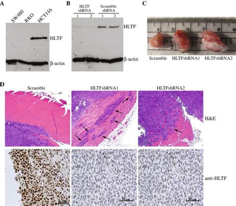 Down Regulation Of Hltf In Human Hct Colon Cancer Cells Promotes