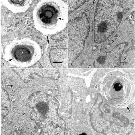 Electron Micrograph Parathyroid Gland Mouse Infused With Parathyroid