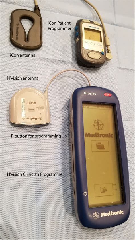 Troubleshooting Interstim Sacral Neuromodulation Generators To Recover Function Pmc