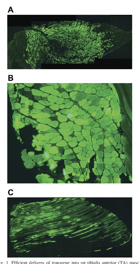 Figure From Ectopic Expression Of Eif B In Rat Skeletal Muscle