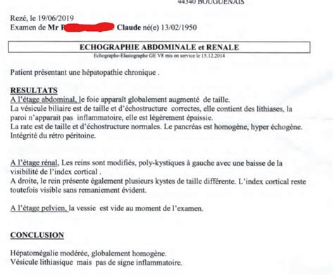 Dr Jean Jacques Fraslin On Twitter Voil Le Compte Rendu Corrig