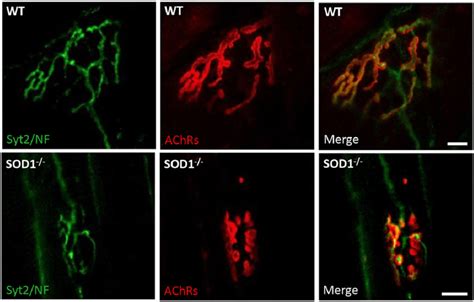 Nmj Immunofluorescence Images From At Muscle Of Sod And Wt Mice At