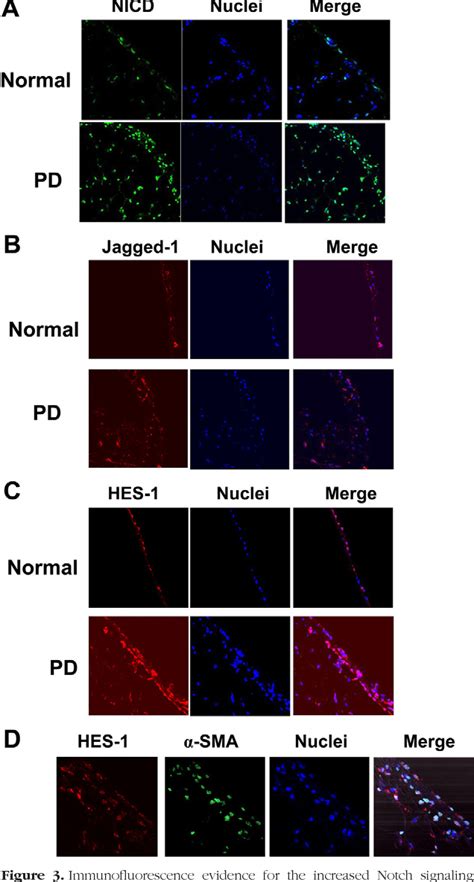 Figure From Cardiovascular Pulmonary And Renal Pathology Preventive