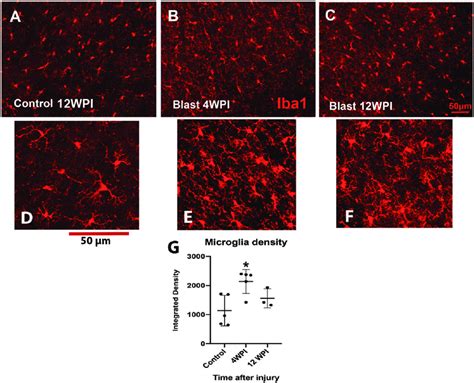 Examples Of Immunoreactivity For Microglia Using Iba1 We Obtained