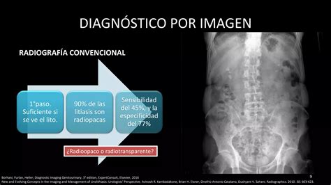 Litiasis Renal Ppt