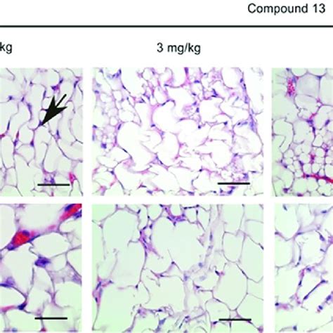 Histopathological Changes In U87 Tumor Xenografts In Nude Mice Treated