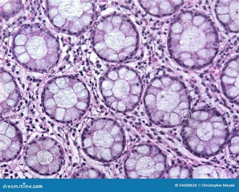 Glandular Tissue