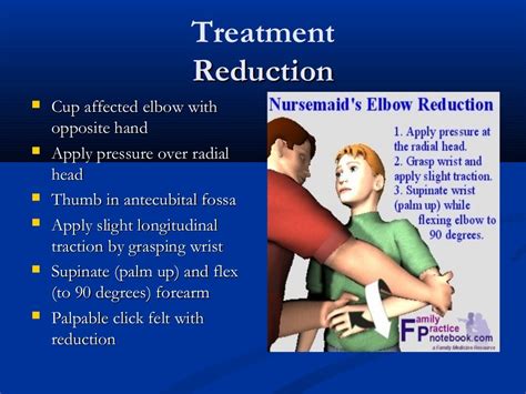 Radial Head Subluxation Nursemaids Elbow”