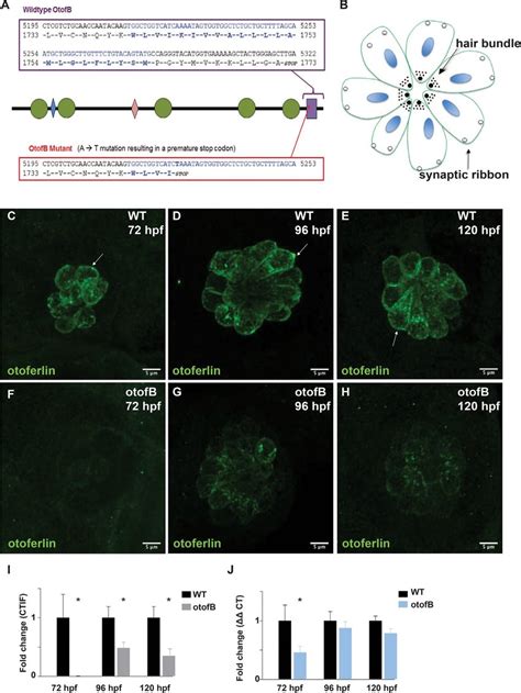 The Otofb Mutation Results In Reduced Otoferlin Expression A