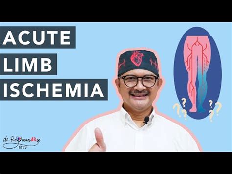 Serial Kuliah Kedokteran Eps 10 Acute Limb Ischemia YouTube