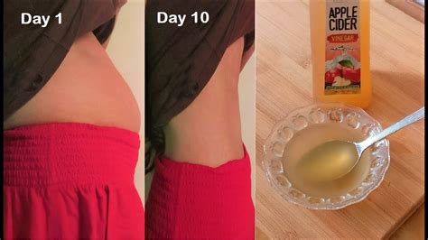 Apple Cider Vinegar For Weight Loss In Week Before And After