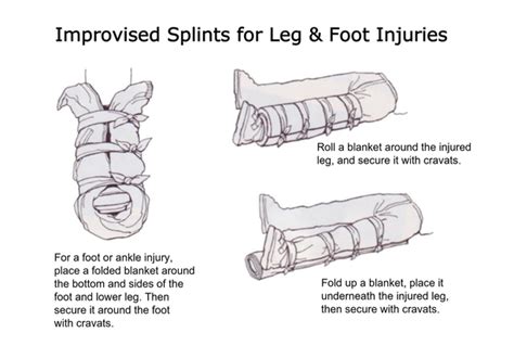 Splinting Fractures And Joints Basic Wilderness First Aid