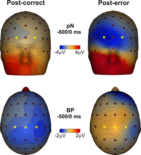 Scalp Topographies Of The Grand Average Activities For Post Correct And