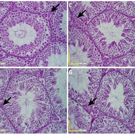 Cross Sections Of Testicular Tissue In Different Experimental Groups