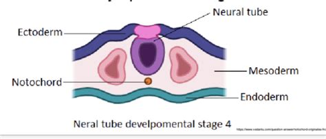 Neonatal Spine Flashcards Quizlet