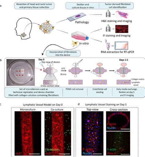 Fibroblasts In Culture