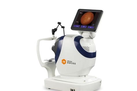 Topcon Introduces Nw500 Non Mydriatic Retinal Camera Antara News