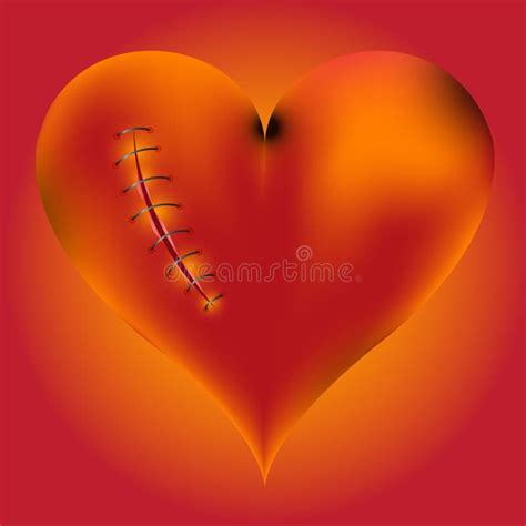 Wounded Heart Stock Illustration Illustration Of Passion 22895223