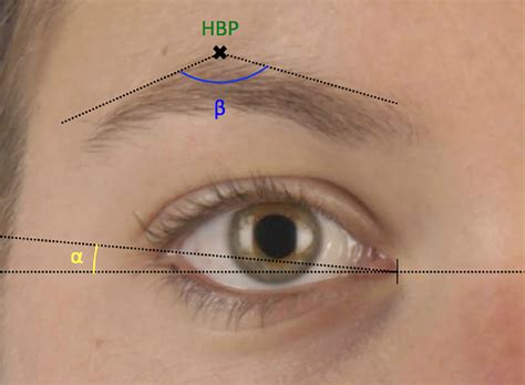 A Morphometric Study Of Age And Sex Dependent Changes In Eyebrow