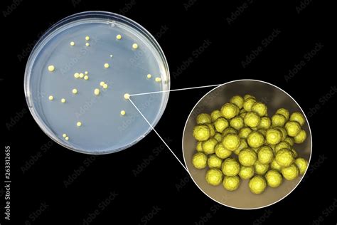 Colonies Of Micrococcus Luteus Bacteria On Agar Plate And Close Up View