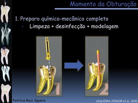 Ppt Obtura O Do Sistema De Canais Radiculares Powerpoint