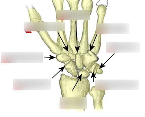 Carpal Bones Diagram Quizlet