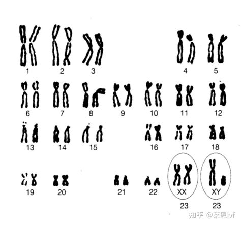 23对染色体分别对应的是哪些症状 知乎