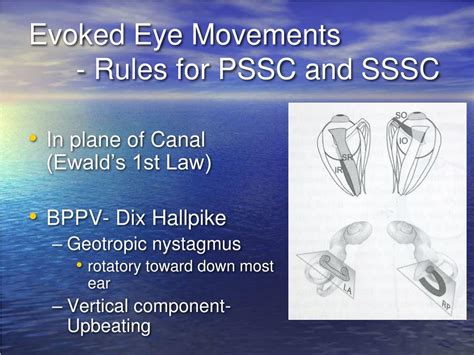 Ppt Superior Semicircular Canal Dehiscence Syndrome Powerpoint