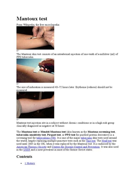 Mantoux Test Medicine Clinical Medicine