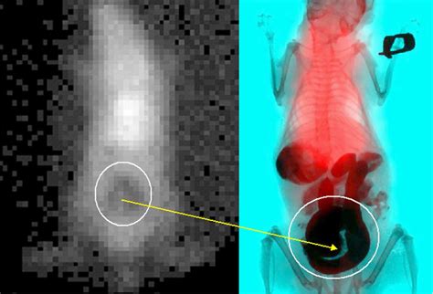 Gamma ray image (left), obtained by the pixellated gamma camera, and ...