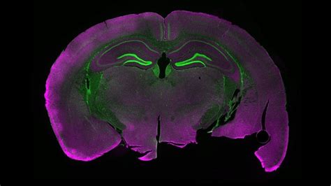 Never-before-seen brain cells discovered in mice. They're called ...