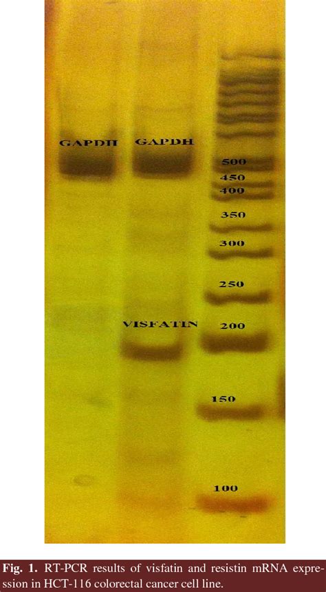 Figure 1 From Resistin And Visfatin Expression In HCT 116 Colorectal