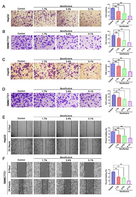 Sevoflurane Inhibits The Metastasis Of Hepatocellular Carcinoma Cells