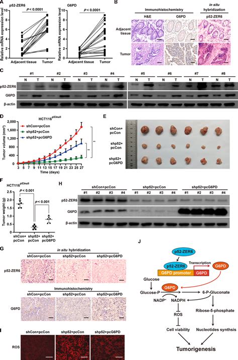 P52 Zer6g6pd Axis Enhances The Tumorigenic Potential Of Crc Cells In A