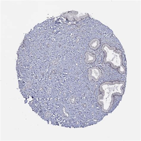 Tissue Expression Of Nceh1 Staining In Cervix The Human Protein Atlas