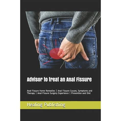 Advisor To Treat An Anal Fissure Anal Fissure Home Remedies Anal