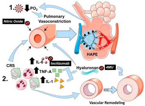 IJMS Free Full Text Emerging Mechanisms Of Pulmonary