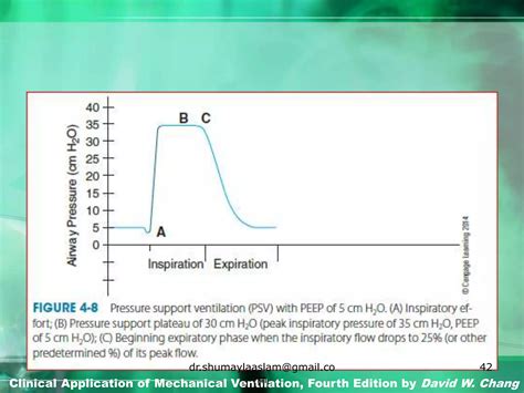 Basic mechanical ventilation settings | PPT