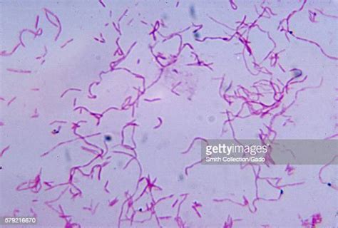 Fusobacterium Nucleatum Photos And Premium High Res Pictures Getty Images