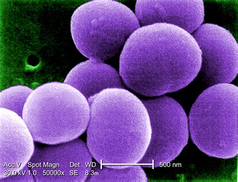 Imagem gratuita estirpe staphylococcus aureus bactérias vancomicina