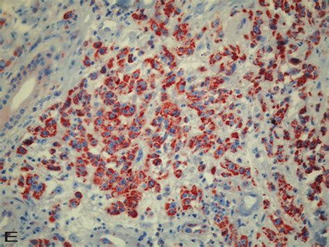 Immunohistochemical Staining For Hsp27 Hsp70 And Hsp60 The Strong