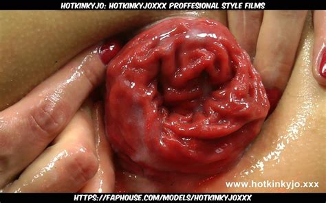 Big Black Buttplug Studio Fun Prolapse By Hotkinkyjo Extreme Insertion Big Tits Porn Xhamster