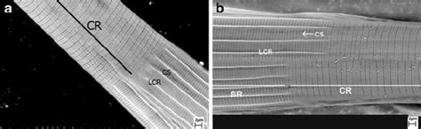 Scanning Electron Micro Graph Of The Cephalic Region Cr And