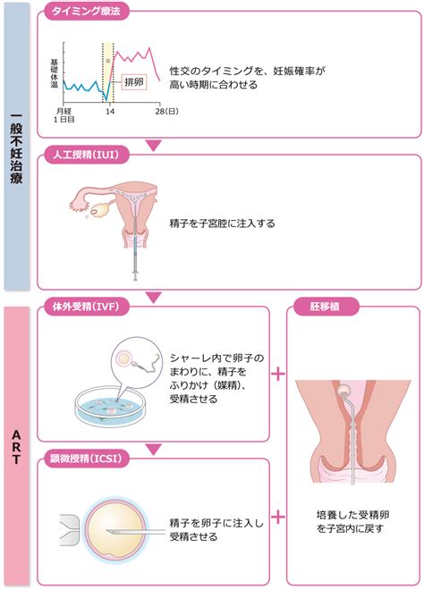 治療の流れ 不妊college