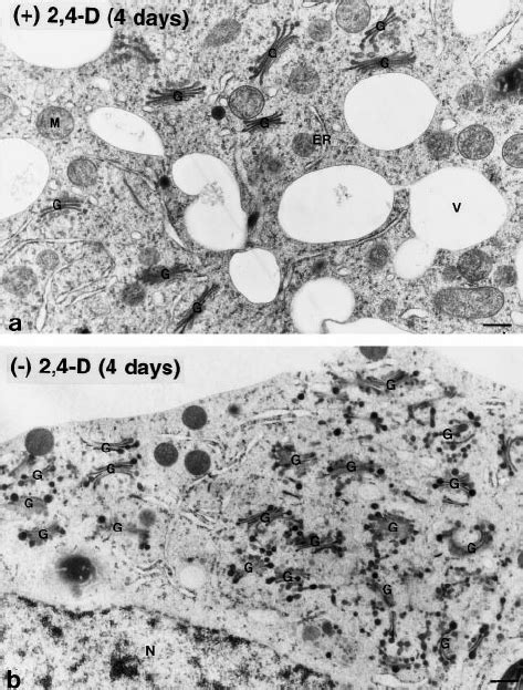 Electron Micrograph Of A Golgi Stack From A Control By 2 Cell The Cis