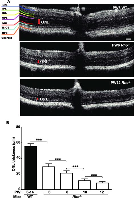 Cross Sectional Oct Images A Representative Retinal Bscan Images Download Scientific Diagram