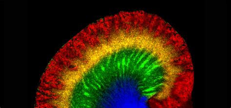 Next Level Imaging Mass Spectrometry Single Cells In Focus With